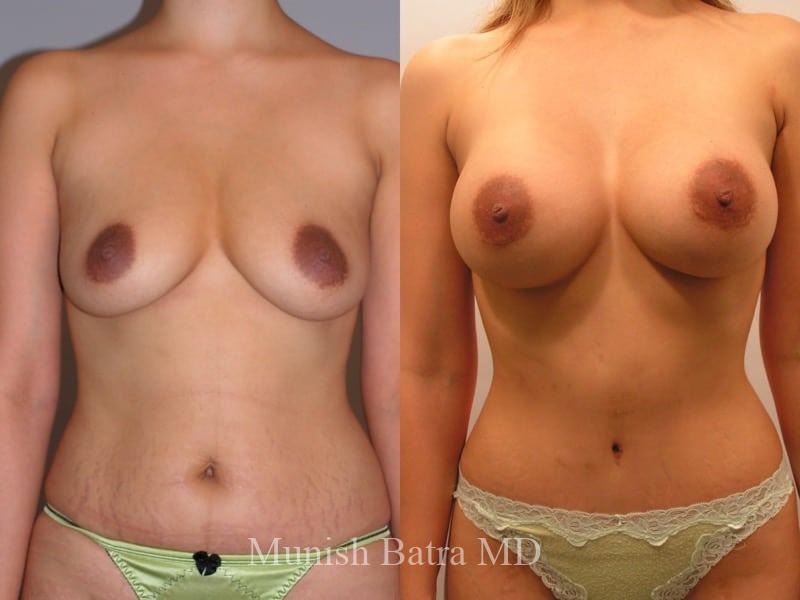 Before and After Image