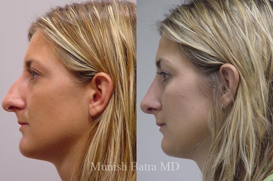 Before and After Image