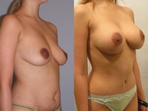 Before and After Image