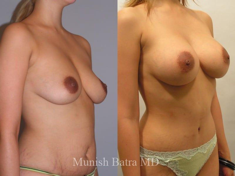 Before and After Image