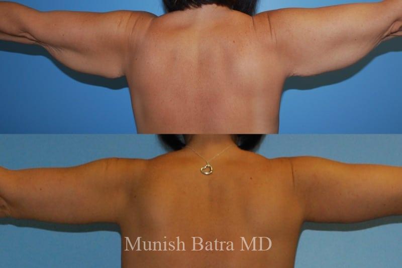Before and After Image