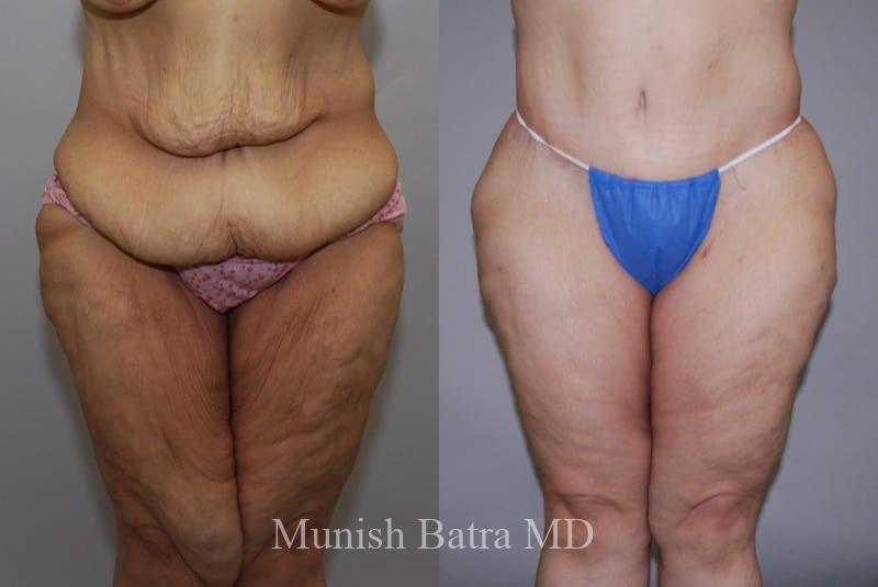 Before and After Image
