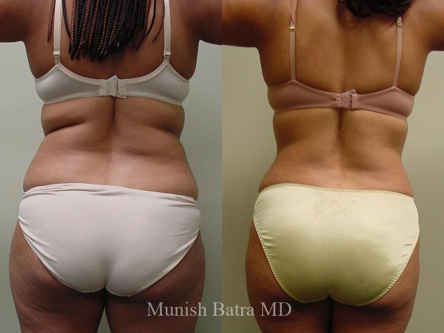 Before and After Image