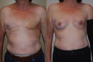 Before and After Image