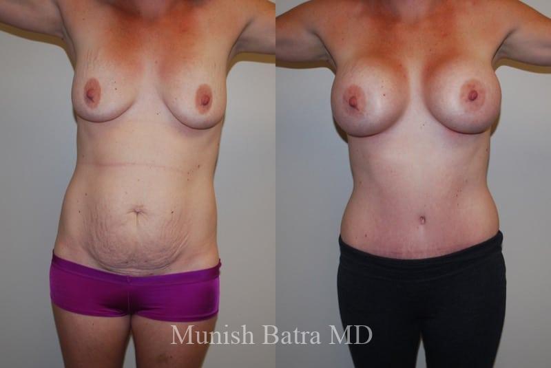 Before and After Image