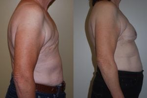 Before and After Image