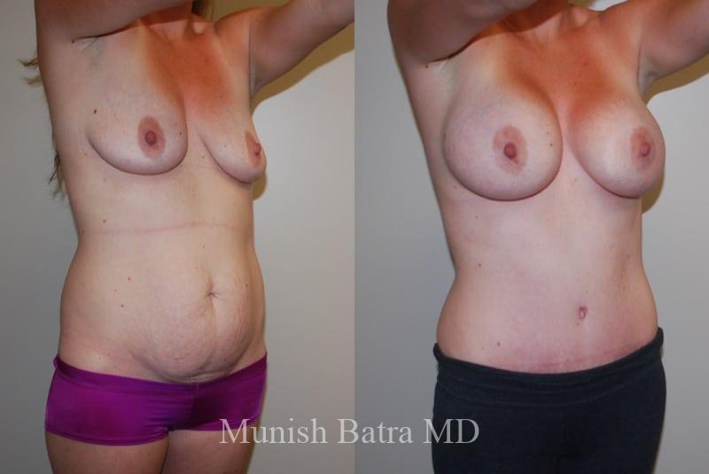Before and After Image