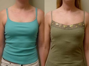 Before and After Image