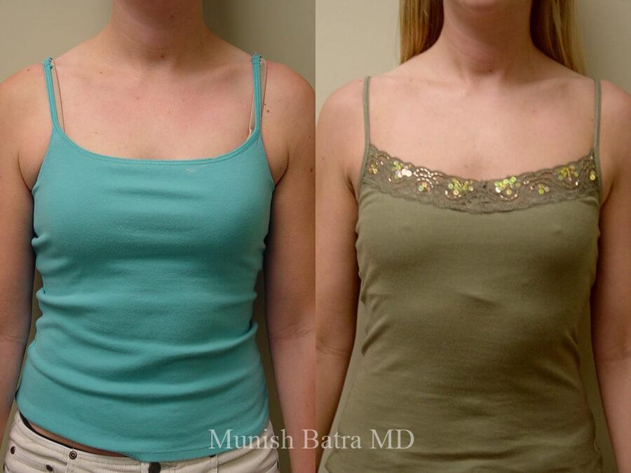 Before and After Image
