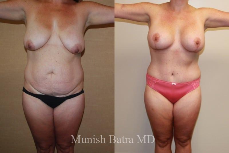 Before and After Image
