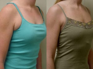 Before and After Image