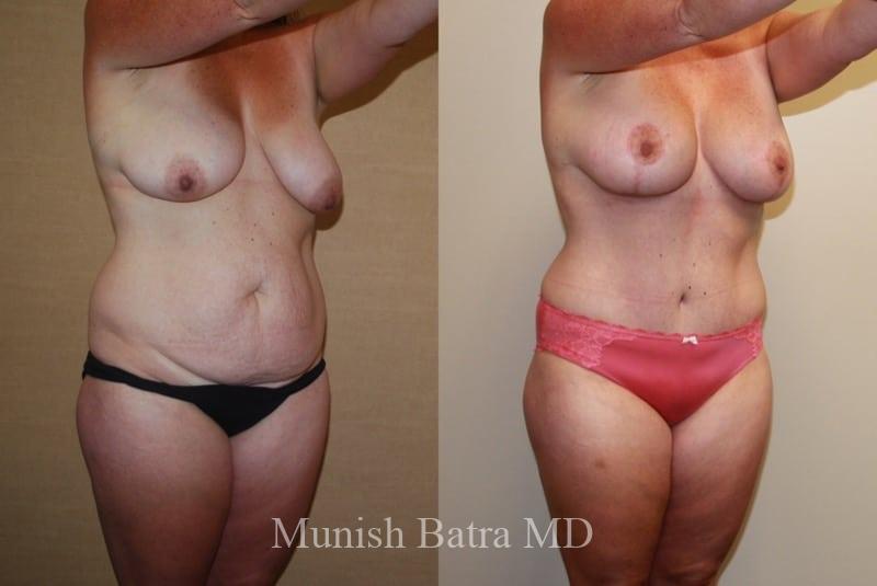 Before and After Image