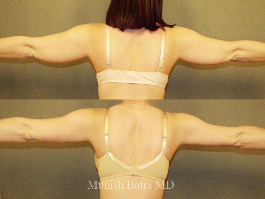 Before and After Image