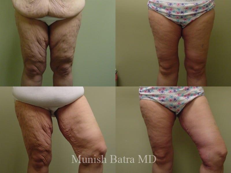 Before and After Image