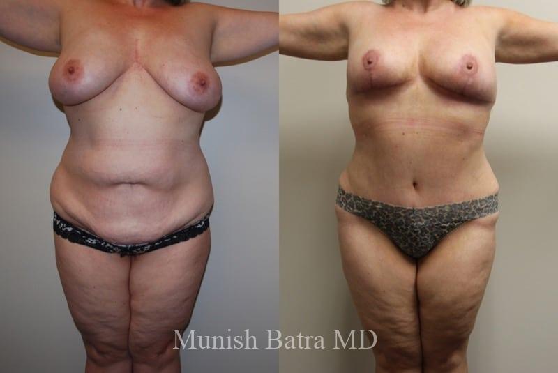 Before and After Image