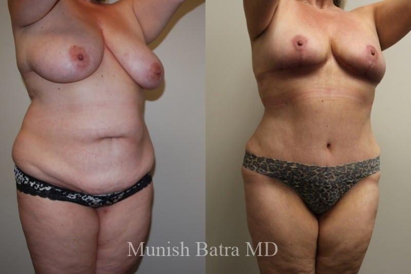 Before and After Image