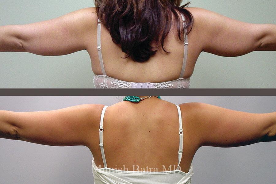 Before and After Image