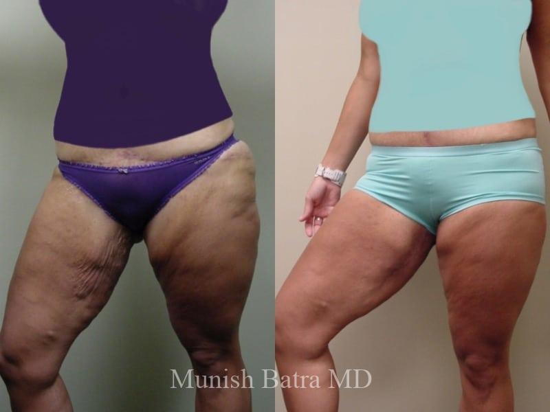 Before and After Image