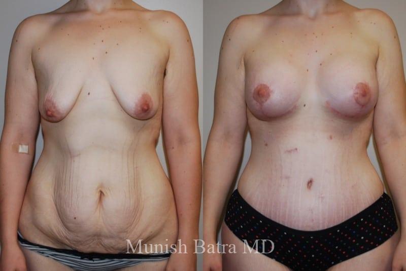 Before and After Image