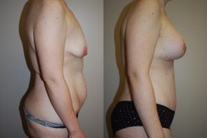 Before and After Image