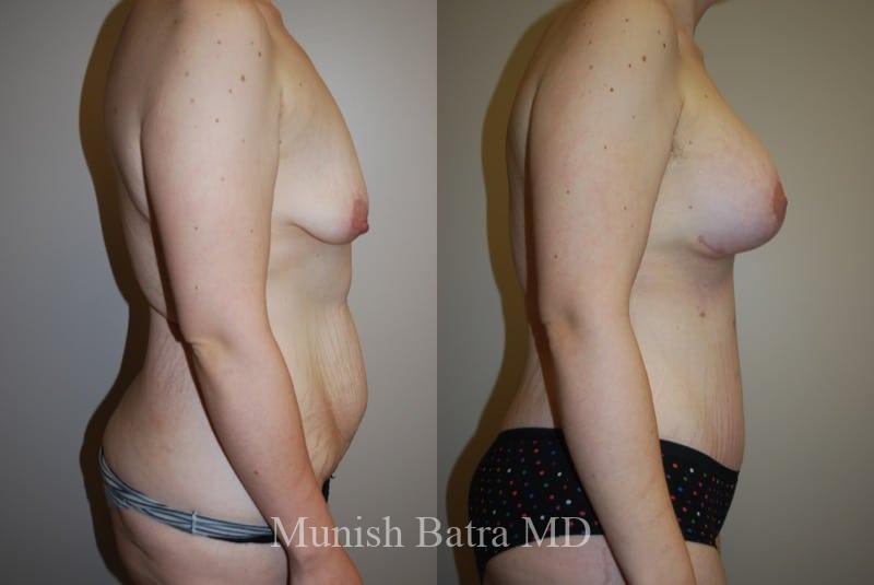Before and After Image