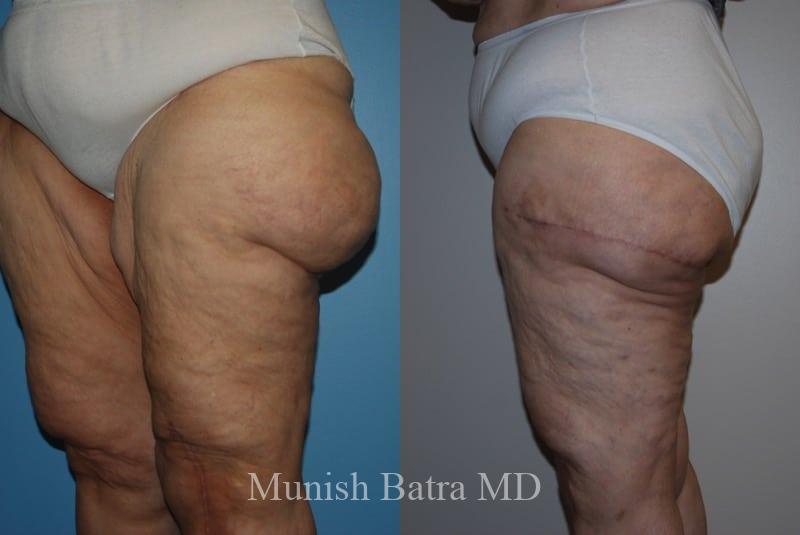 Before and After Image