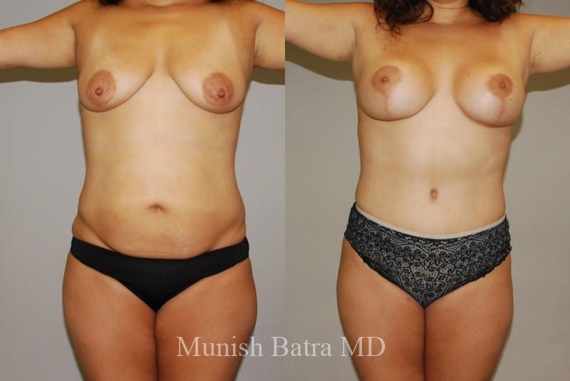 Before and After Image