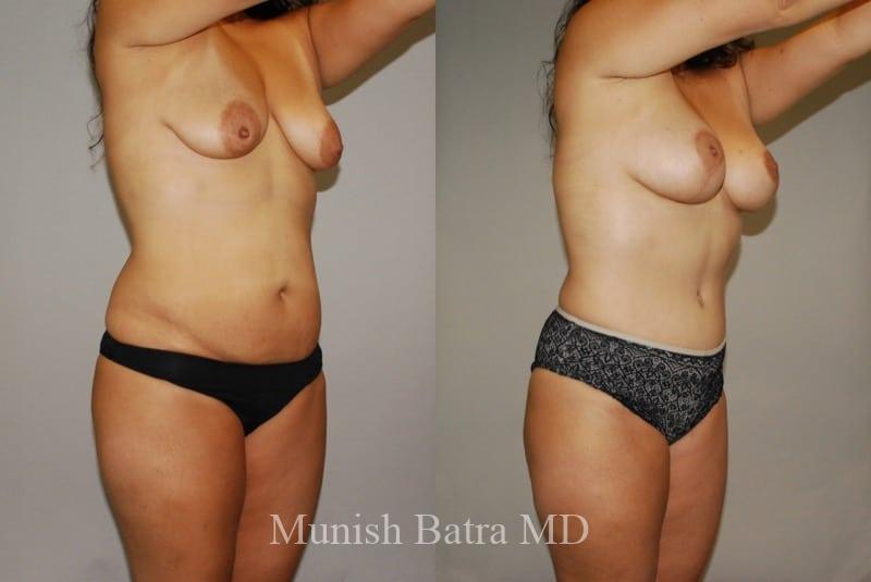 Before and After Image