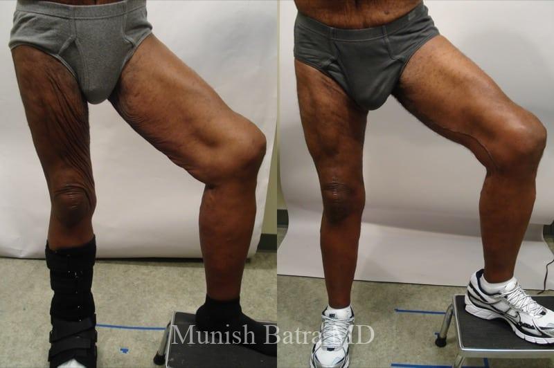 Before and After Image