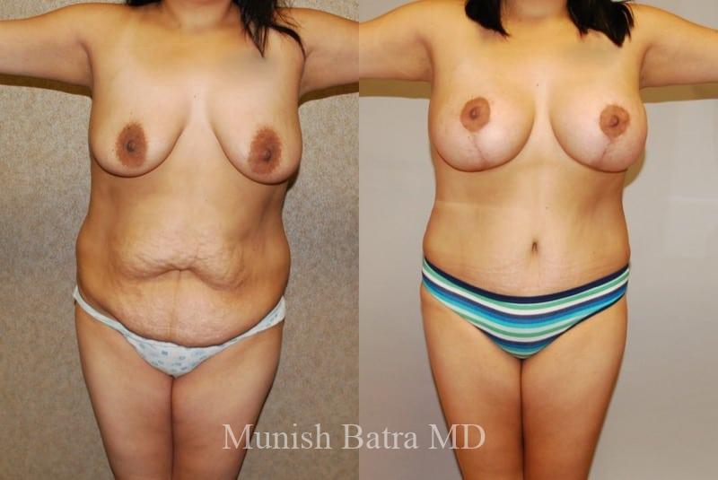 Before and After Image