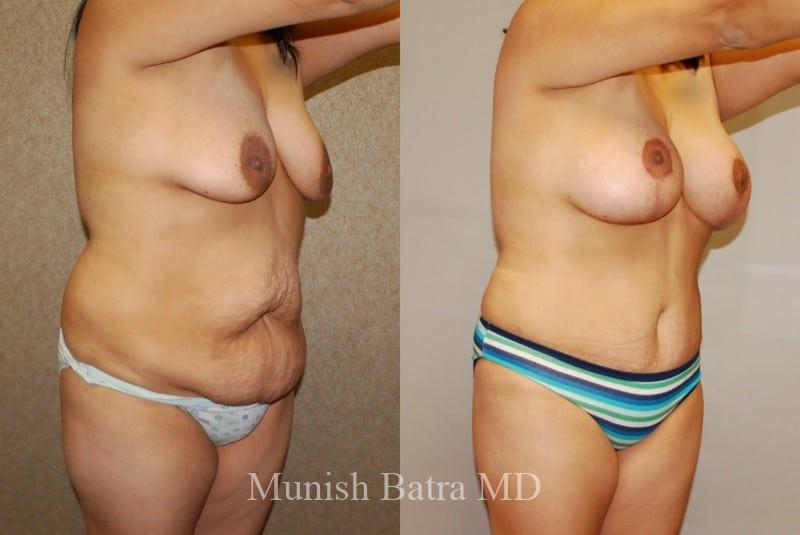 Before and After Image