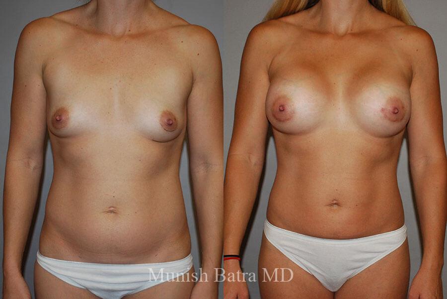 Before and After Image