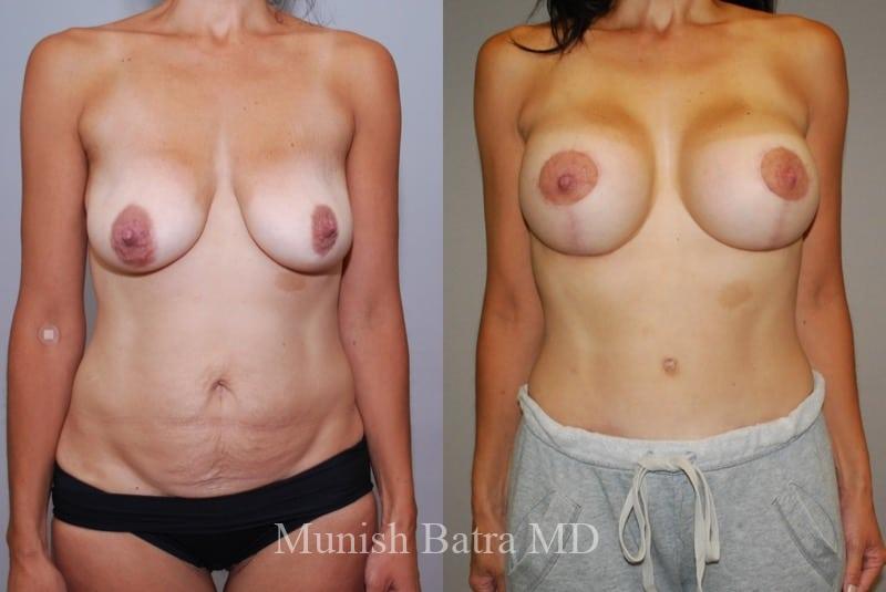 Before and After Image