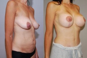 Before and After Image