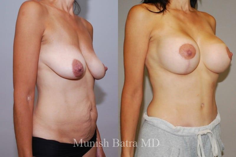 Before and After Image
