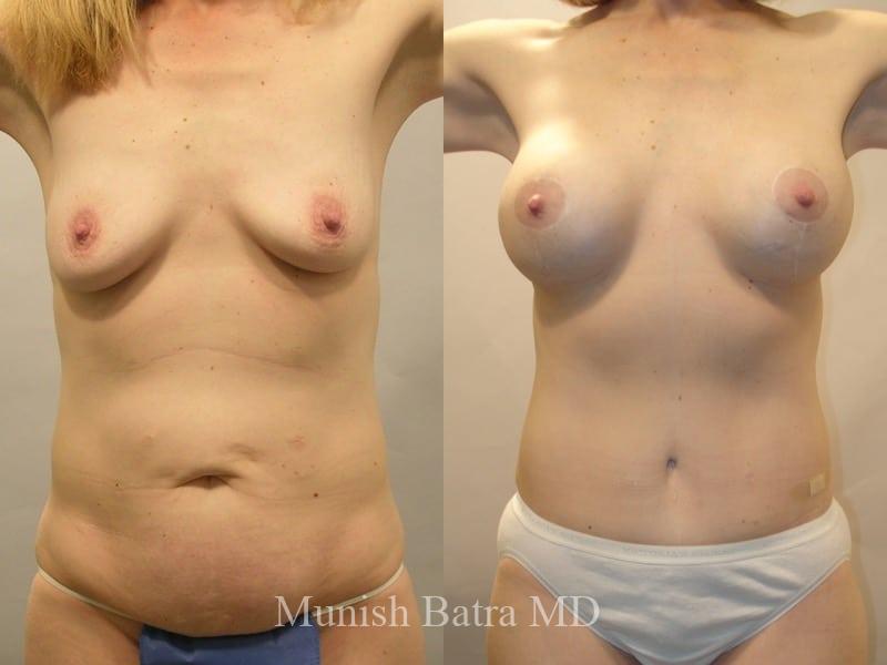 Before and After Image