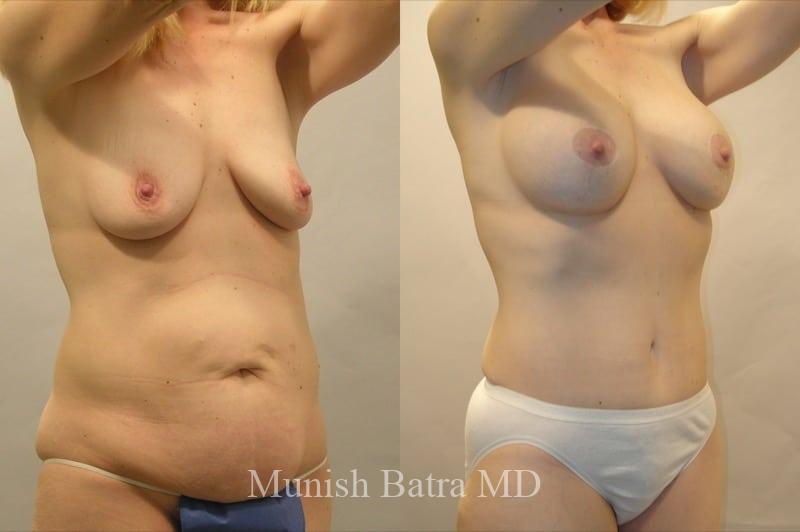 Before and After Image