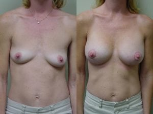 Before and After Image