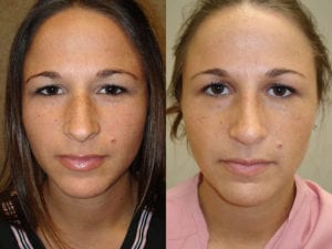Before and After Image