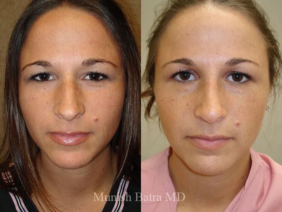 Before and After Image