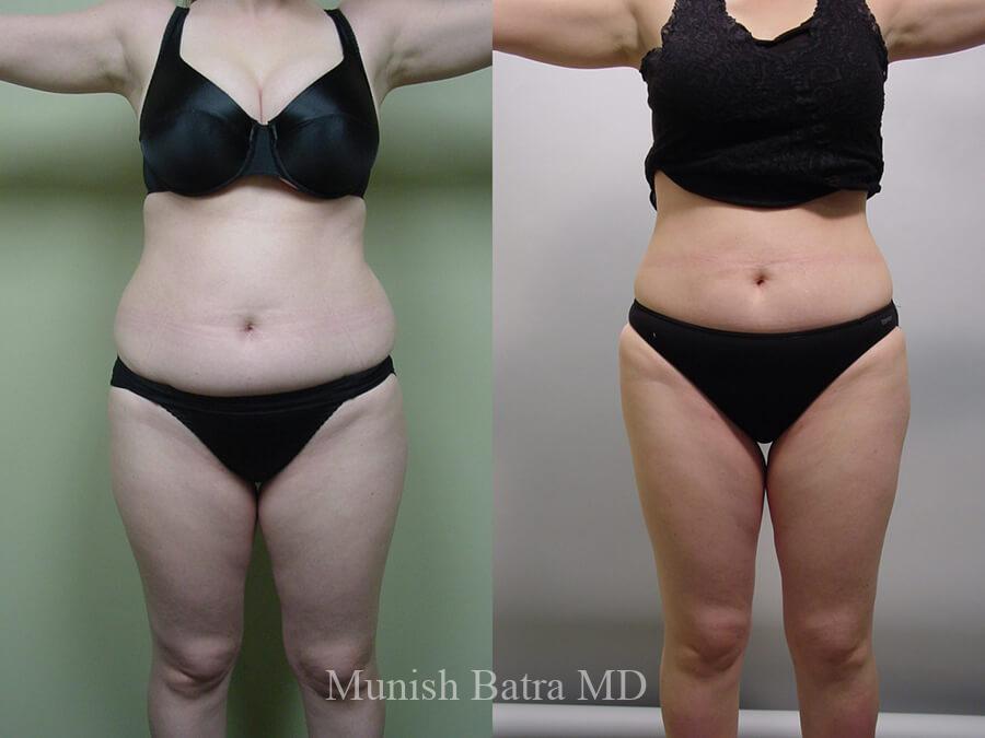 Before and After Image