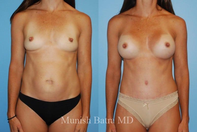 Before and After Image