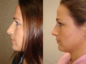 Before and After Image