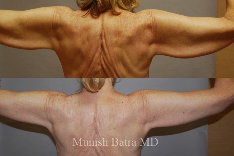 Before and After Image