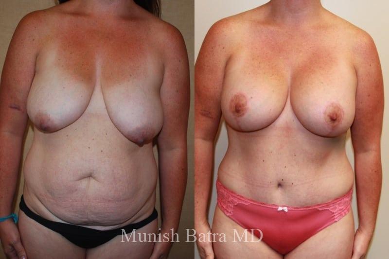 Before and After Image