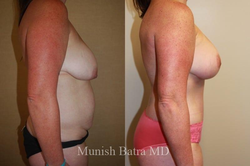Before and After Image