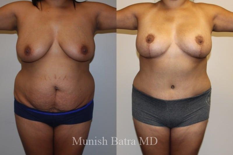 Before and After Image