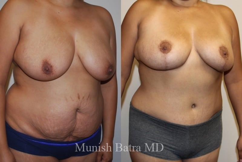 Before and After Image
