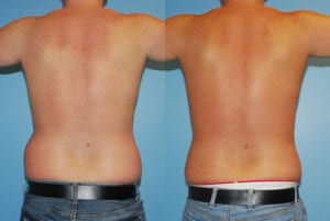 Before and After Image