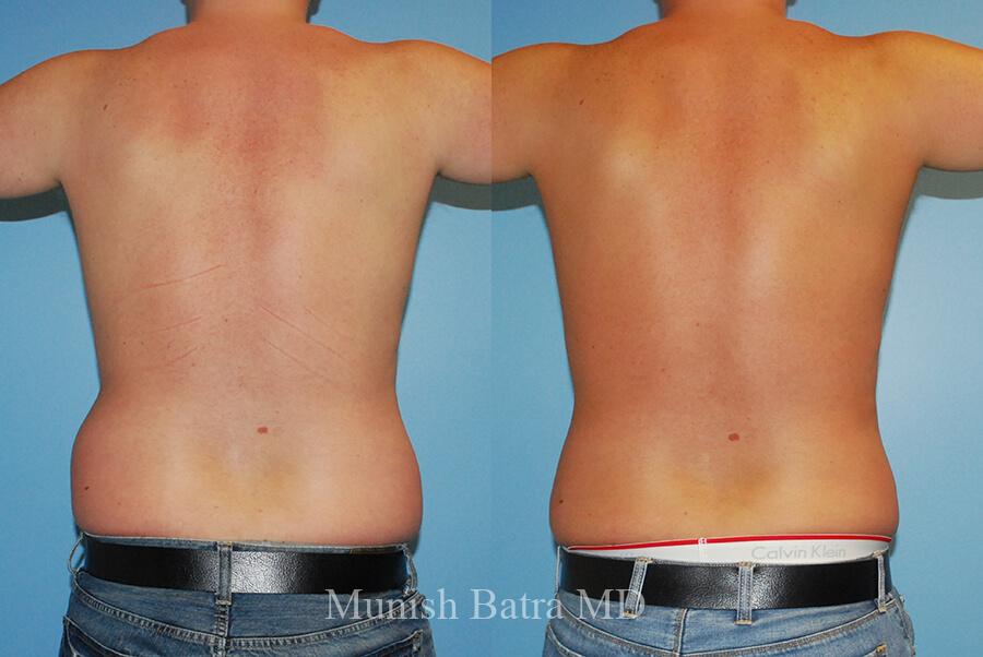 Before and After Image